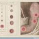 Image for article titled 'Nothing Short of Attempted Murder': A Brief History of Anti-Vaxxers